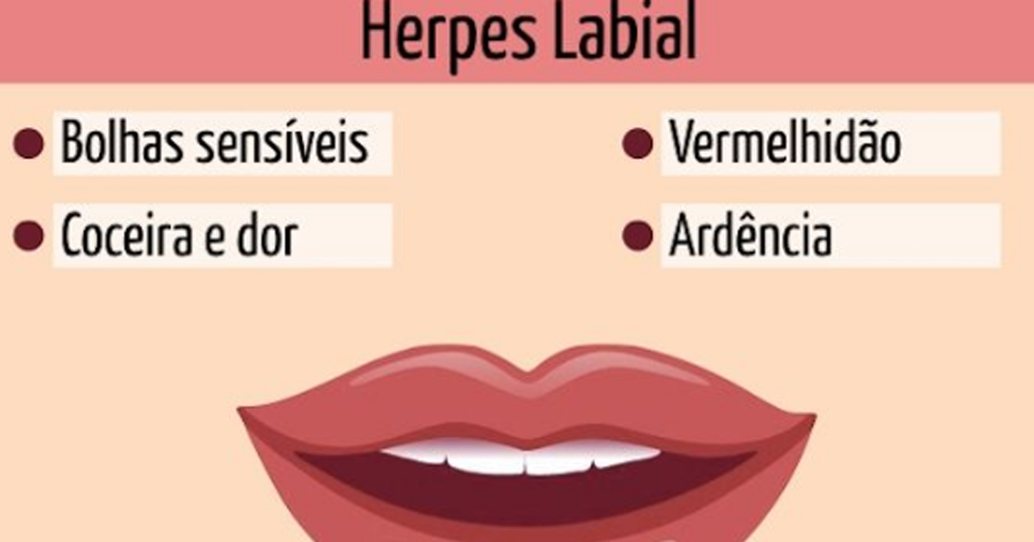 herpes labial